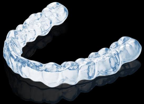 A Practical Guide to Choosing Smarter Orthodontic Options with lulusmiles